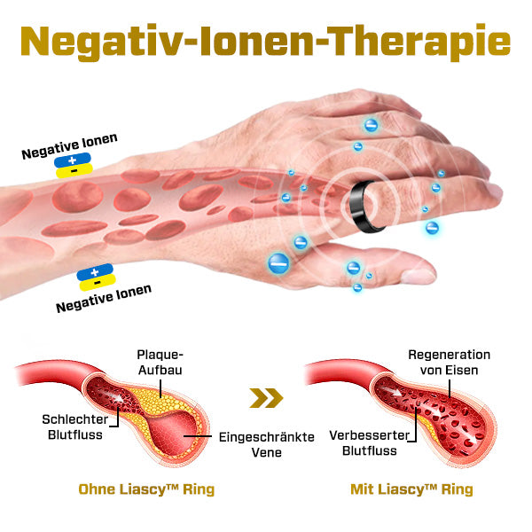 Liascy™ ProVital IonRing