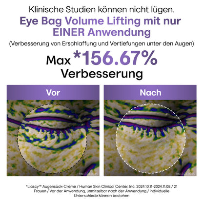 60 Sekunden bis zum Ergebnis - Liascy™ Augensack-Creme