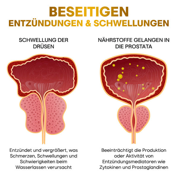 Healve™ BeeBoom Nasaler Inhalator für Prostata-Wellness