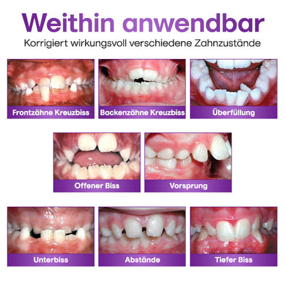 ToothClear Unsichtbare Zahnspange Set