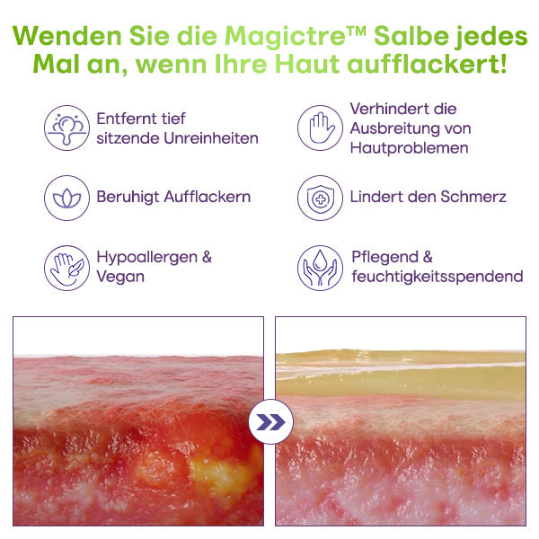 Magictre™ Ultimative Hautlösungs-Salbe