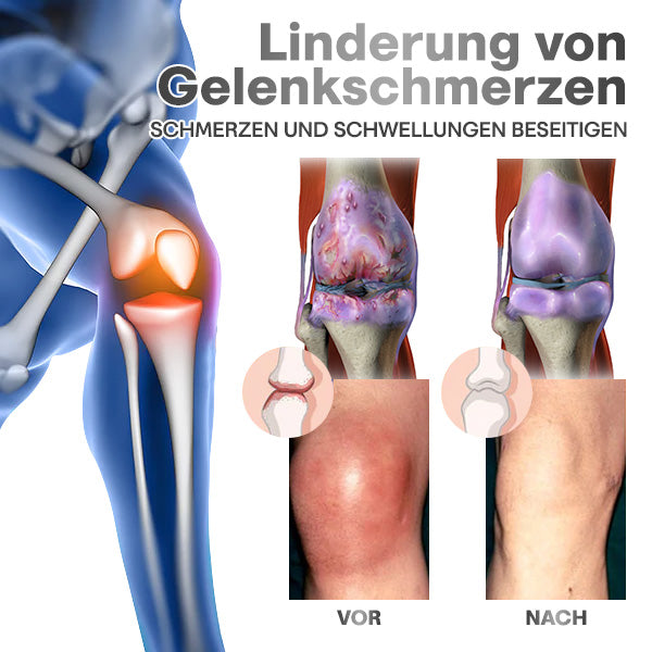 OsteoFlexify™ DualAction Knochen- und Gelenkheilungscreme