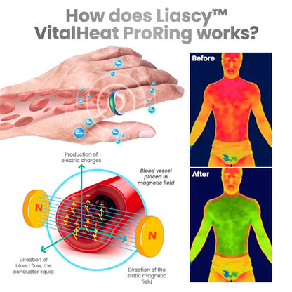 Liascy™ VitalHeat ProRing